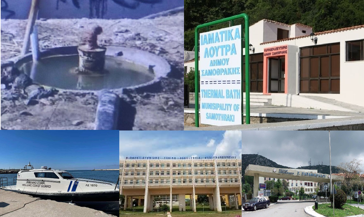Εγκαύματα Ιαματικά Λουτρά ΠΓΝΑ Παπανικολάου